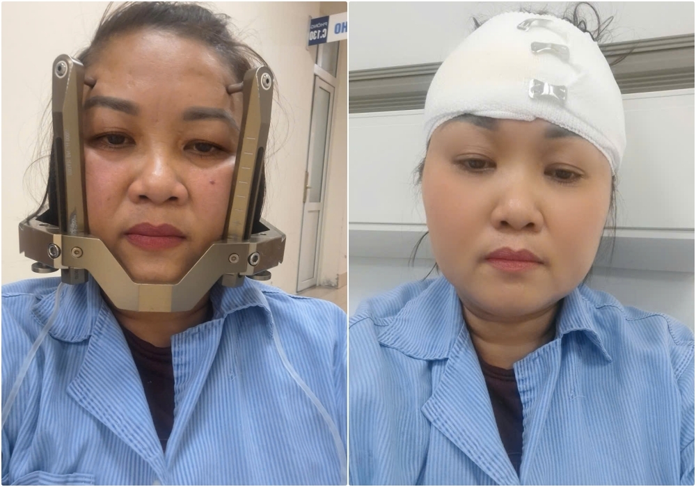 Mẹ ung thư giai đoạn cuối: ‘Em không sợ chết, chỉ sợ con 15 tuổi bơ vơ’
